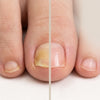 ClearStep™ Toenail Renewal Oil — 30ml Brush-On Applicator