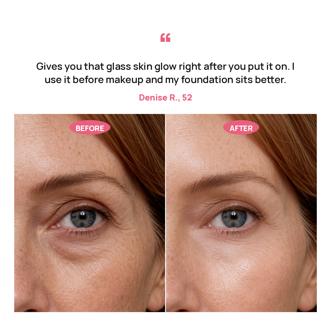 PDRN Pink Collagen Volume Multi Balm 5